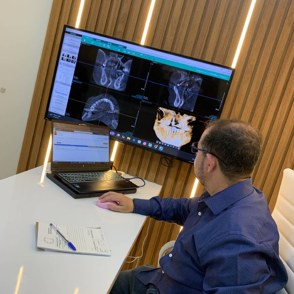 Dr. Caio na CC Freitas Odontologia, dentista em Campinas, analisa tomografia computadorizada para planejamento de prótese protocolo em monitor.